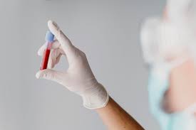 Mês Mundial da Hemofilia: médica explica os principais mitos sobre doença rara que afeta a coagulação do sangue