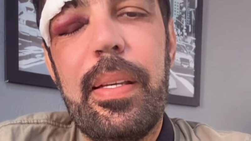 Jornalista Thiago Sodré sofre acidente doméstico e passa por cirurgia no olho