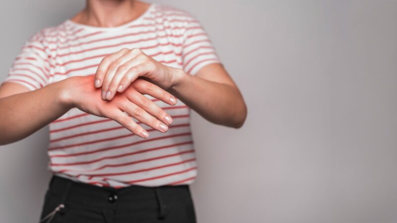 Hanseníase ainda é um desafio de saúde pública no Brasil